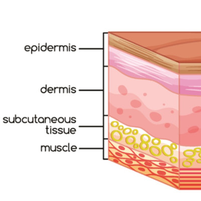 SKIN CONDITIONS